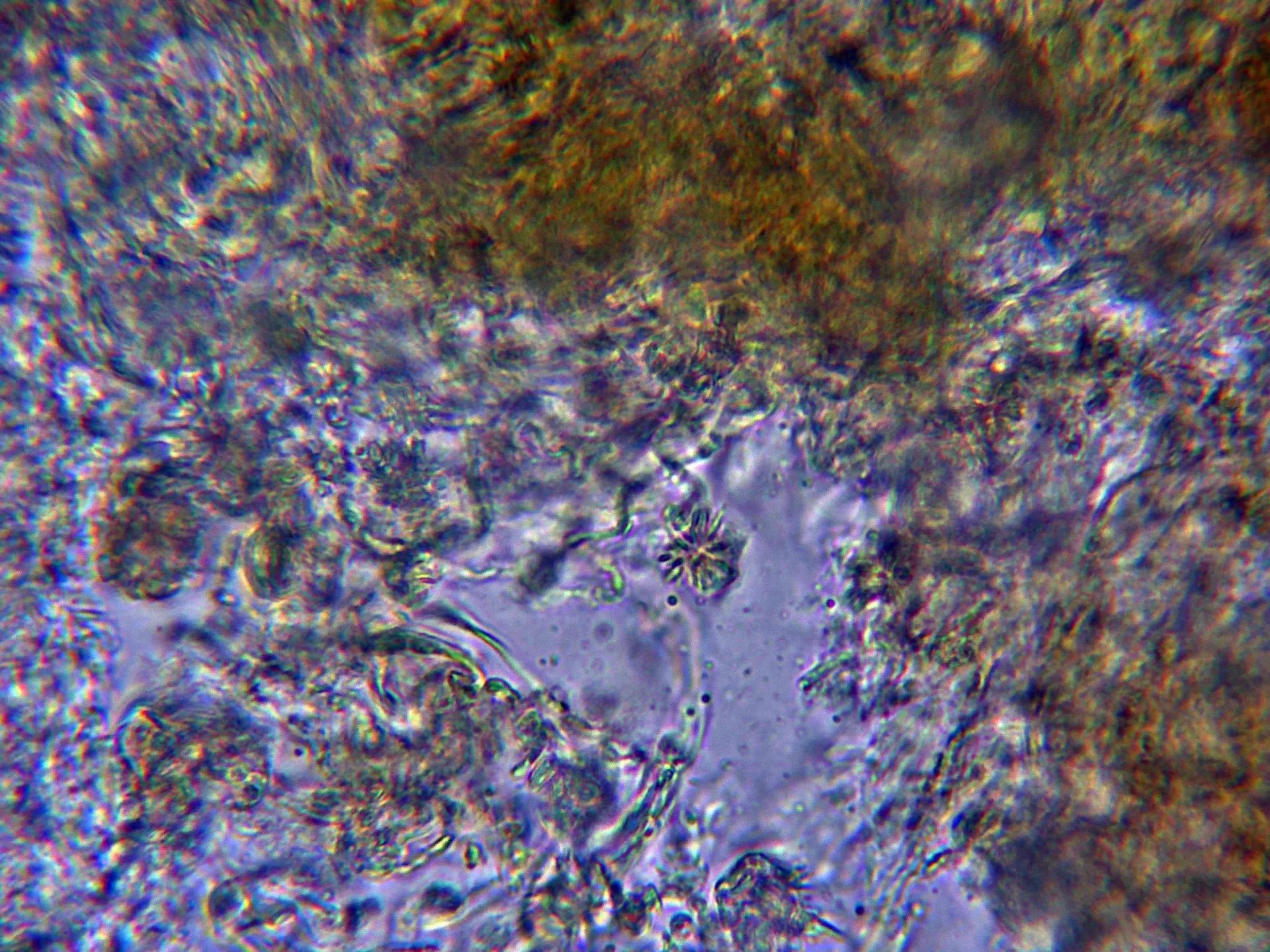 Microscopía de Resinicium saccharicola - 10 - Cristales Melzer-001